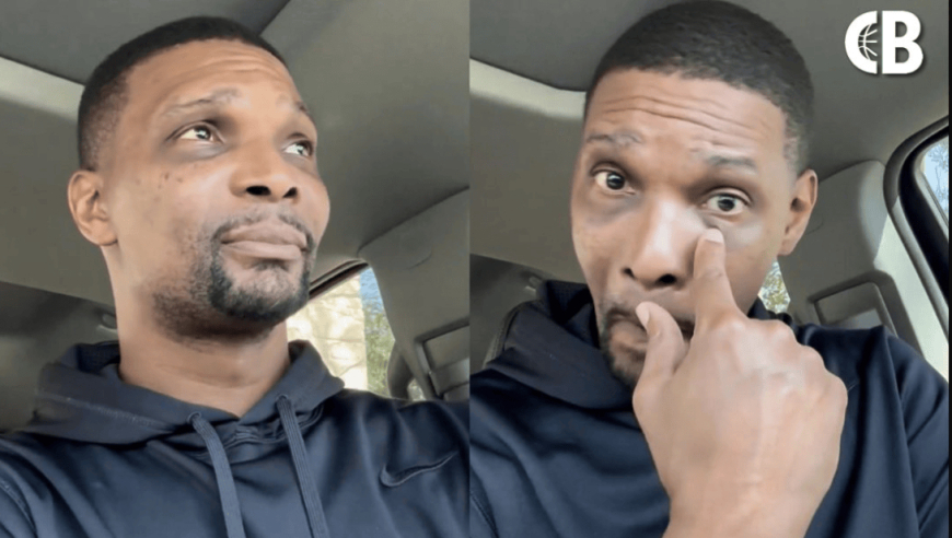 波什自述生死惊魂：准备去约会时突然晕倒，醒来满身是血