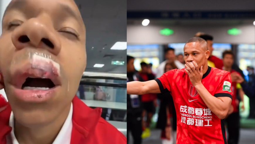成都外援妻子讲述伤势，嘴唇裂开缝了15针+牙齿移位 只能吃流食