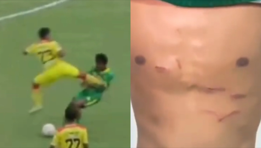 杀人动作！印尼球员把对手胸口飞踹出数条伤口，被终身禁赛