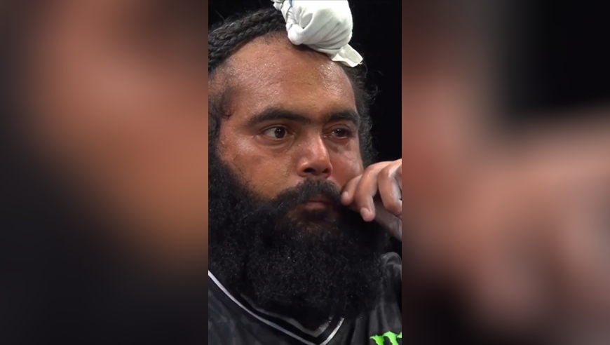 这抗击打能力太恐怖，一耳光下去缕缕胡子啥事儿没有