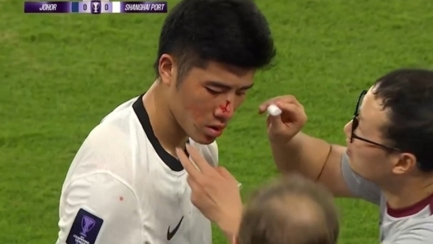 亚冠巨大争议！李圣龙被踩破相，对手恶劣动作逃红，记者开炮