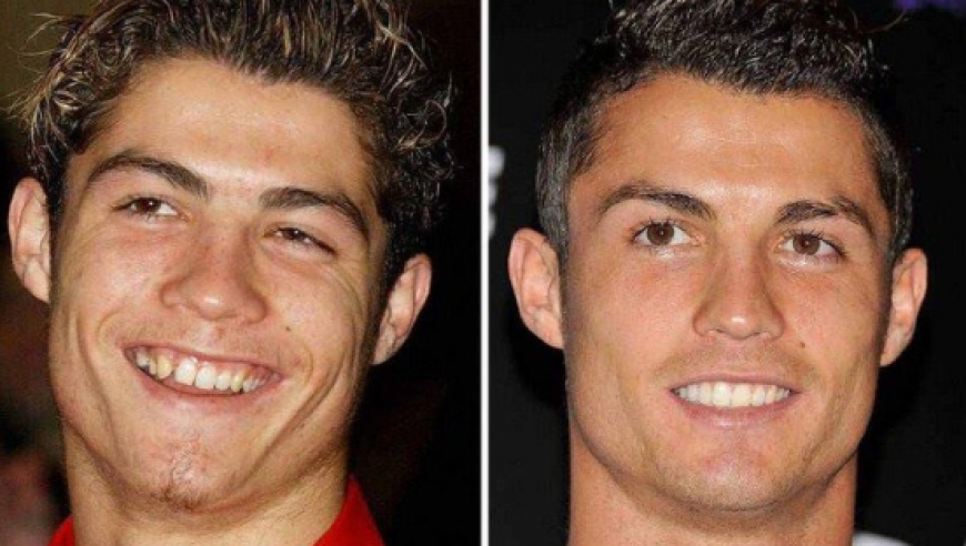 巨星被爆料多次整容，22年内曾经整牙、隆鼻、植发……团队暂无回应