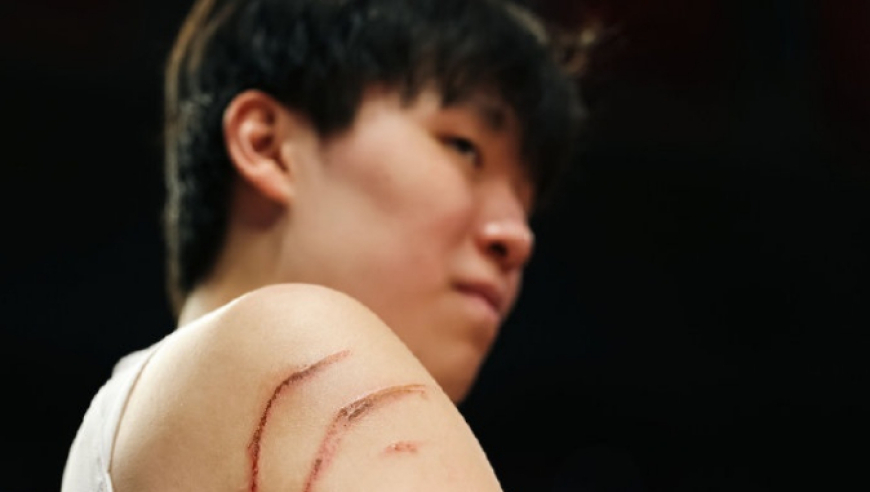 杨瀚森工作室回应小杨被抓出血痕：是伤痕 也是成长路上的拼搏勋章