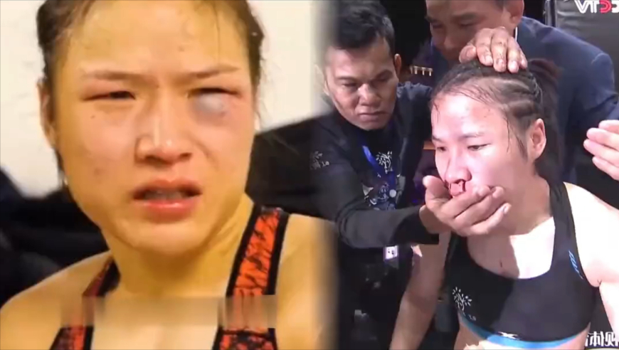 体坛记忆｜张伟丽鼻梁被打断，带伤鏖战绝不放弃，终凭毅力逆风翻盘