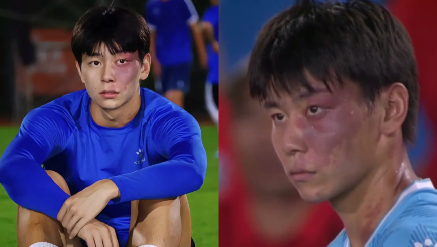 竞者 | 胎记少年“一眼封神”：梦碎中超，沉淀苏超，他跟自己和解