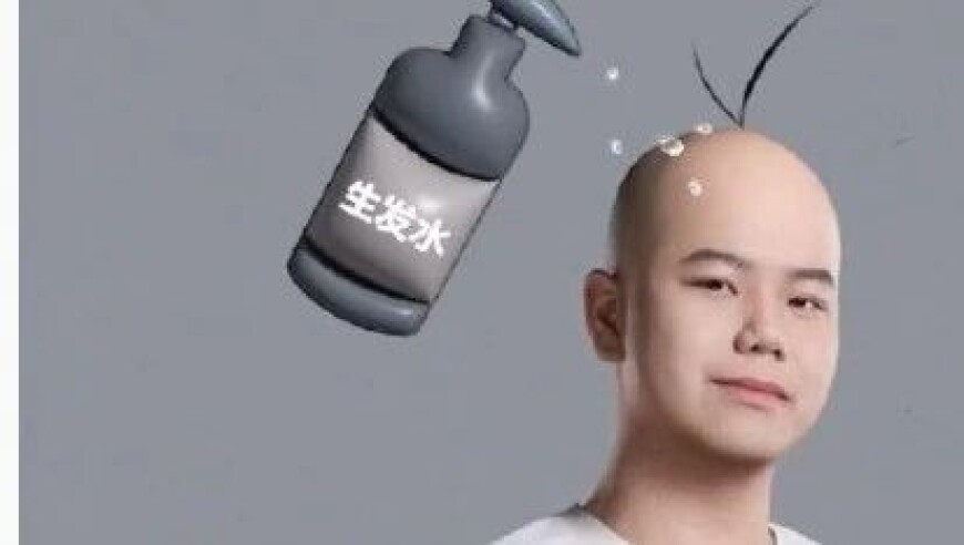 Shadow是对的！BLG让一追二成功复仇AL！难道BLG又要回来了？